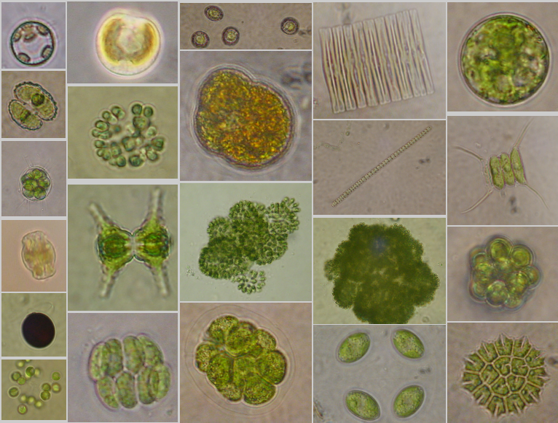 Planktongemeinschaften unterm Mikroskop, Foto: UFZ